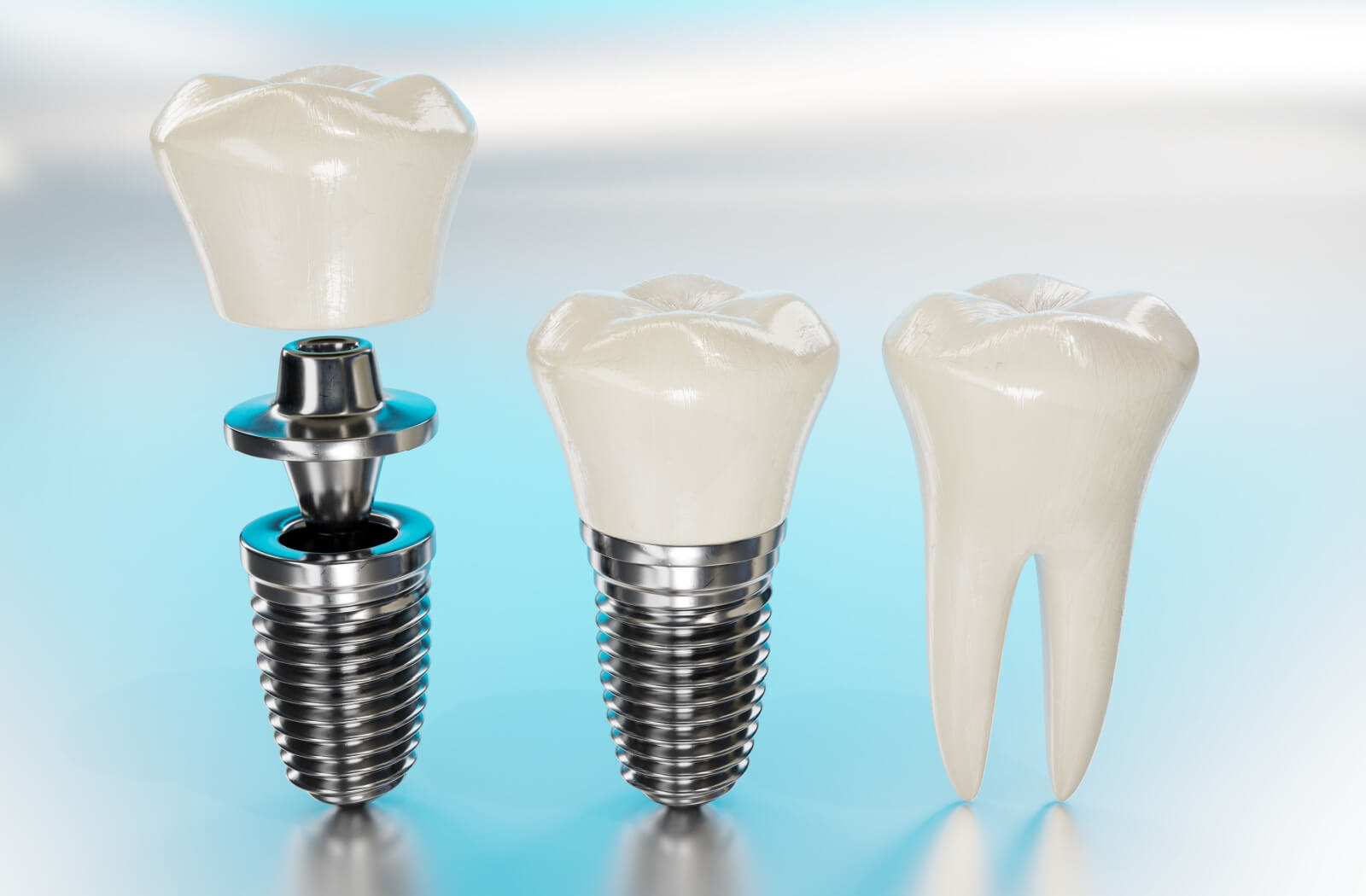 3D rendering of a set of titanium dental implants on a bright blue studio background.